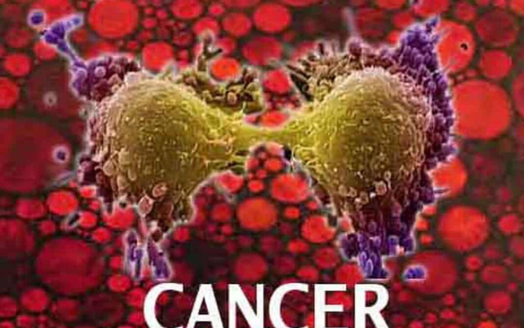 सावधान! रोज की ये छोटी-छोटी आदतें बढ़ा देती हैं कैंसर का खतरा, आज से ही कर लें इनमें सुधार
